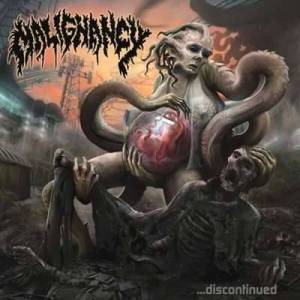  Malignancy - Discontinued